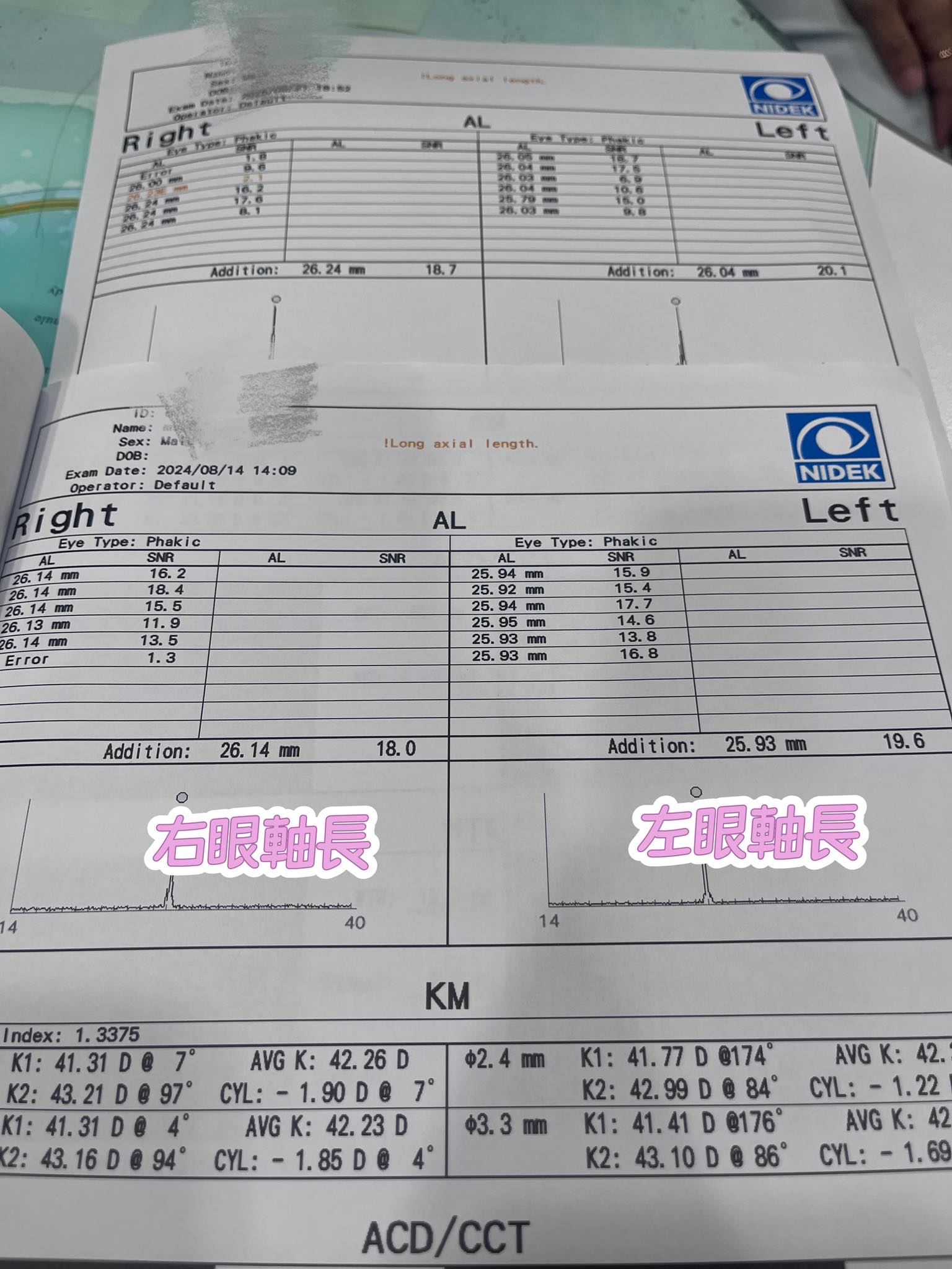 開學視力季 開始發視力單囉