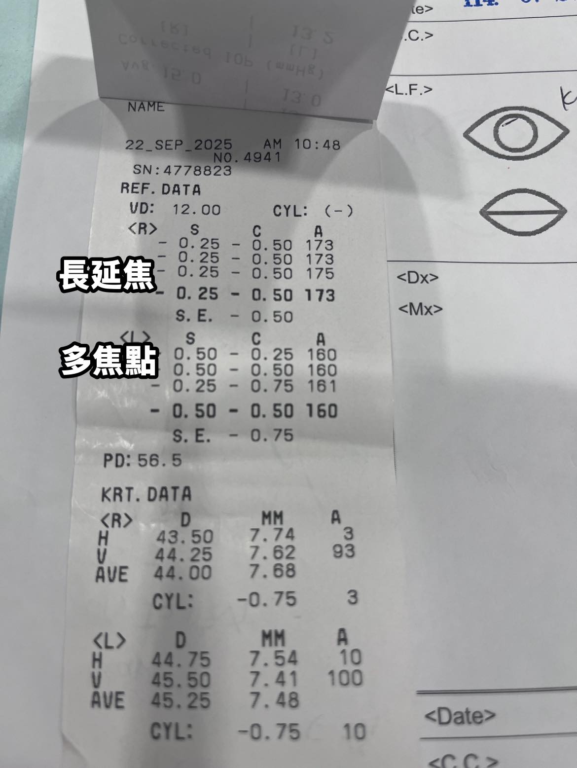 長延焦vs多焦點
