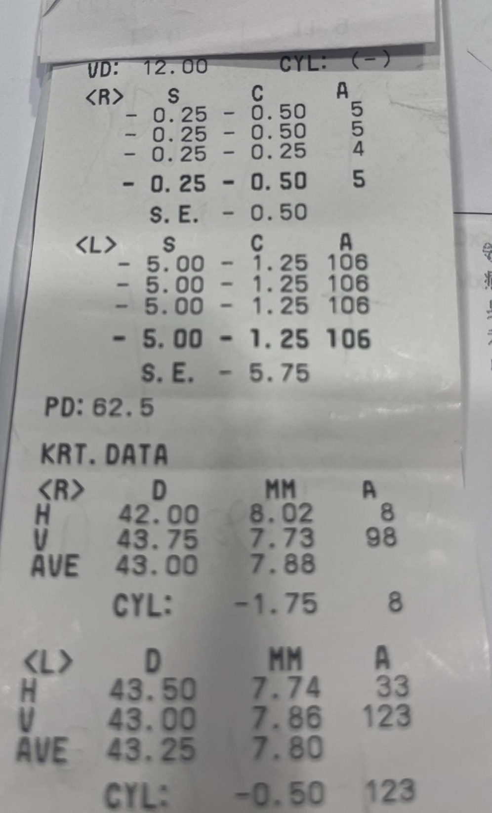 白內障年輕化案例照片2