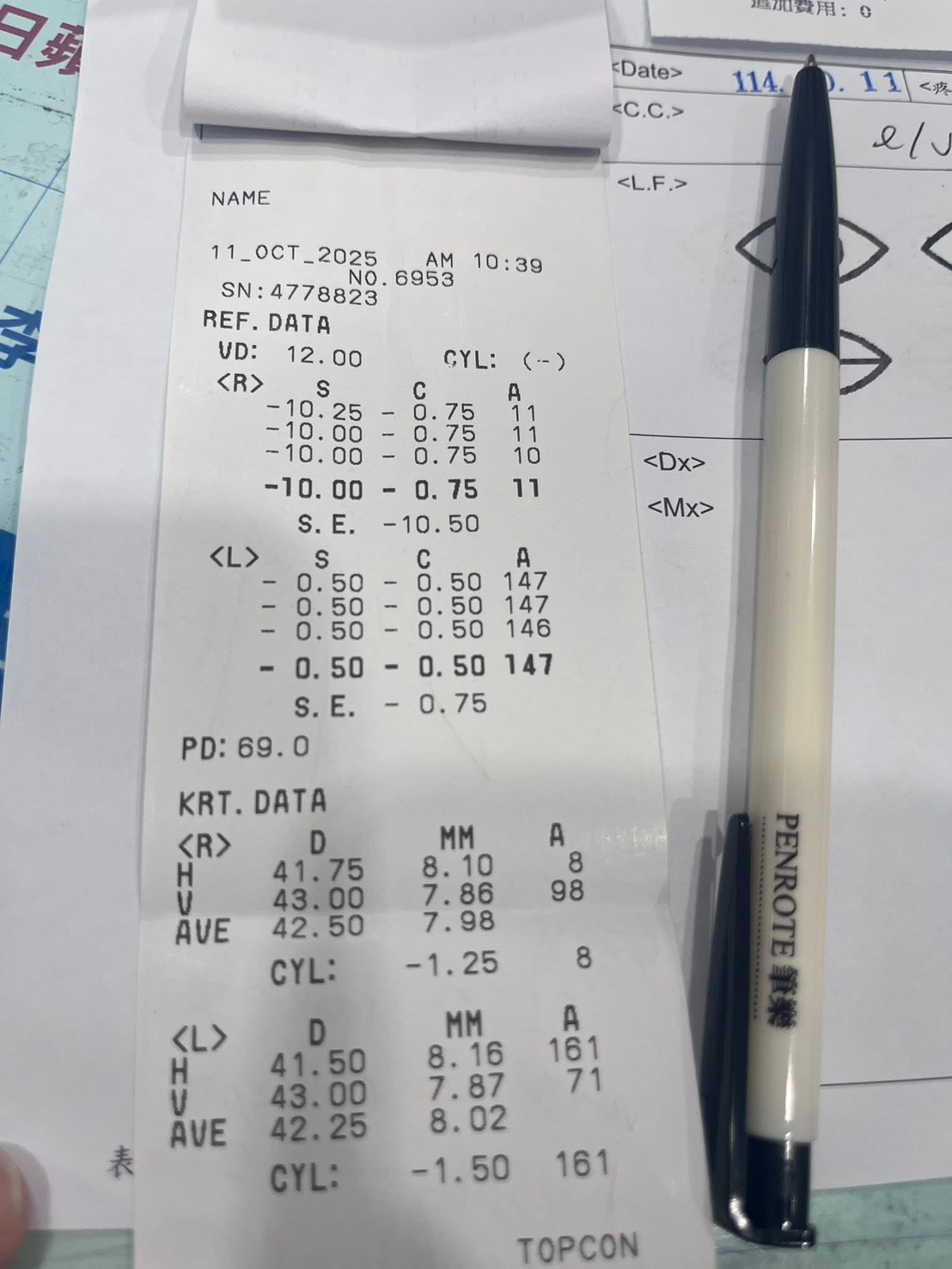 台南白內障案例分享｜年輕患者開刀一年後仍維持穩定視力與漂亮度數✨