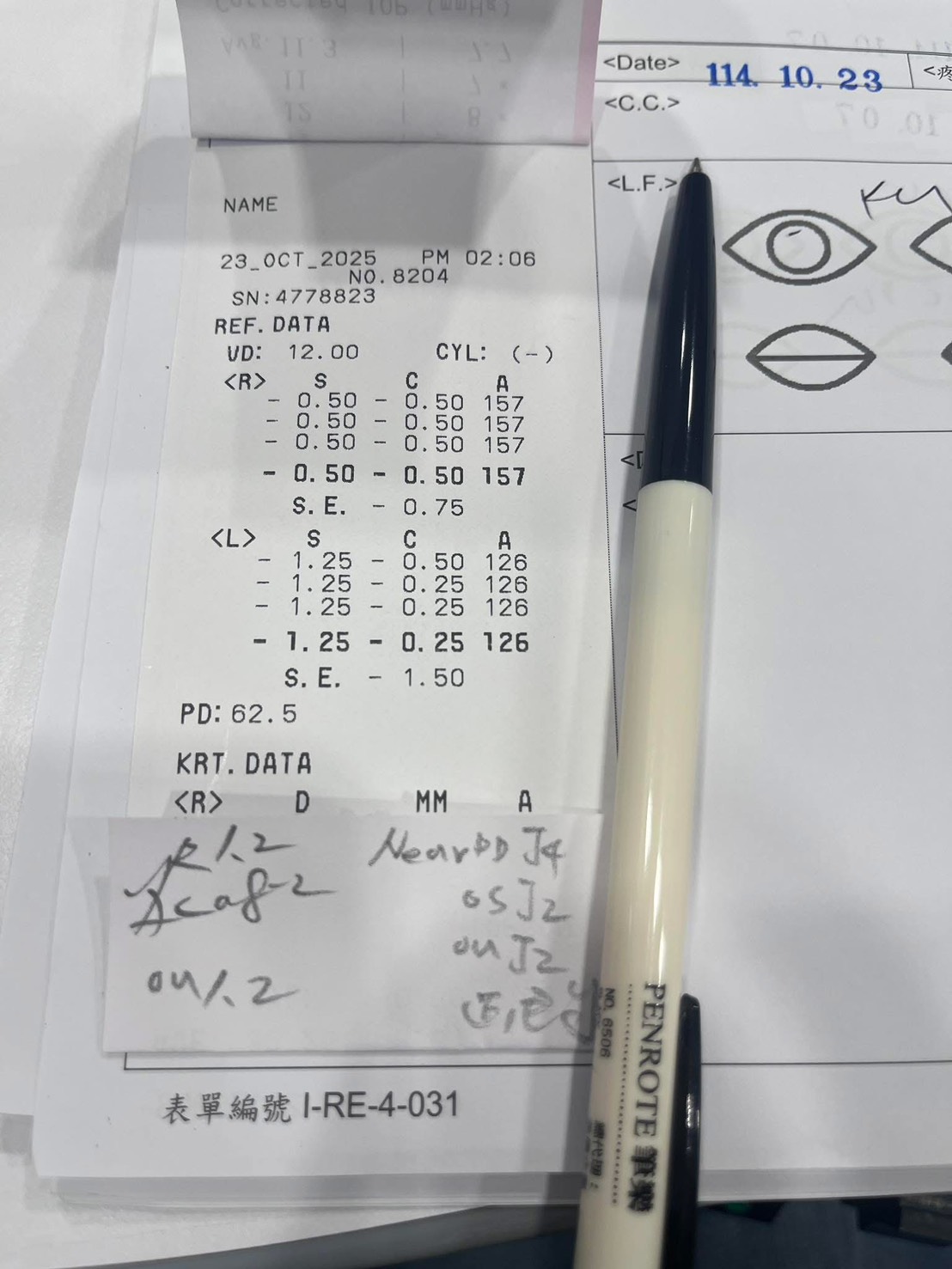 藍眼淚的夜晚｜白內障＋近視雷射 術後第一天｜台南近視雷射